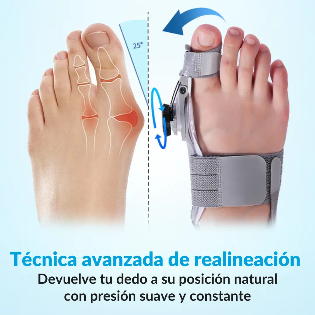 FlexToe Pro™ - Corrige el juanete sin cirugía desde casa