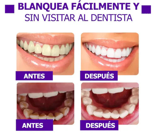 Obsessive White® — Tu sonrisa más blanca sin dañar el esmalte