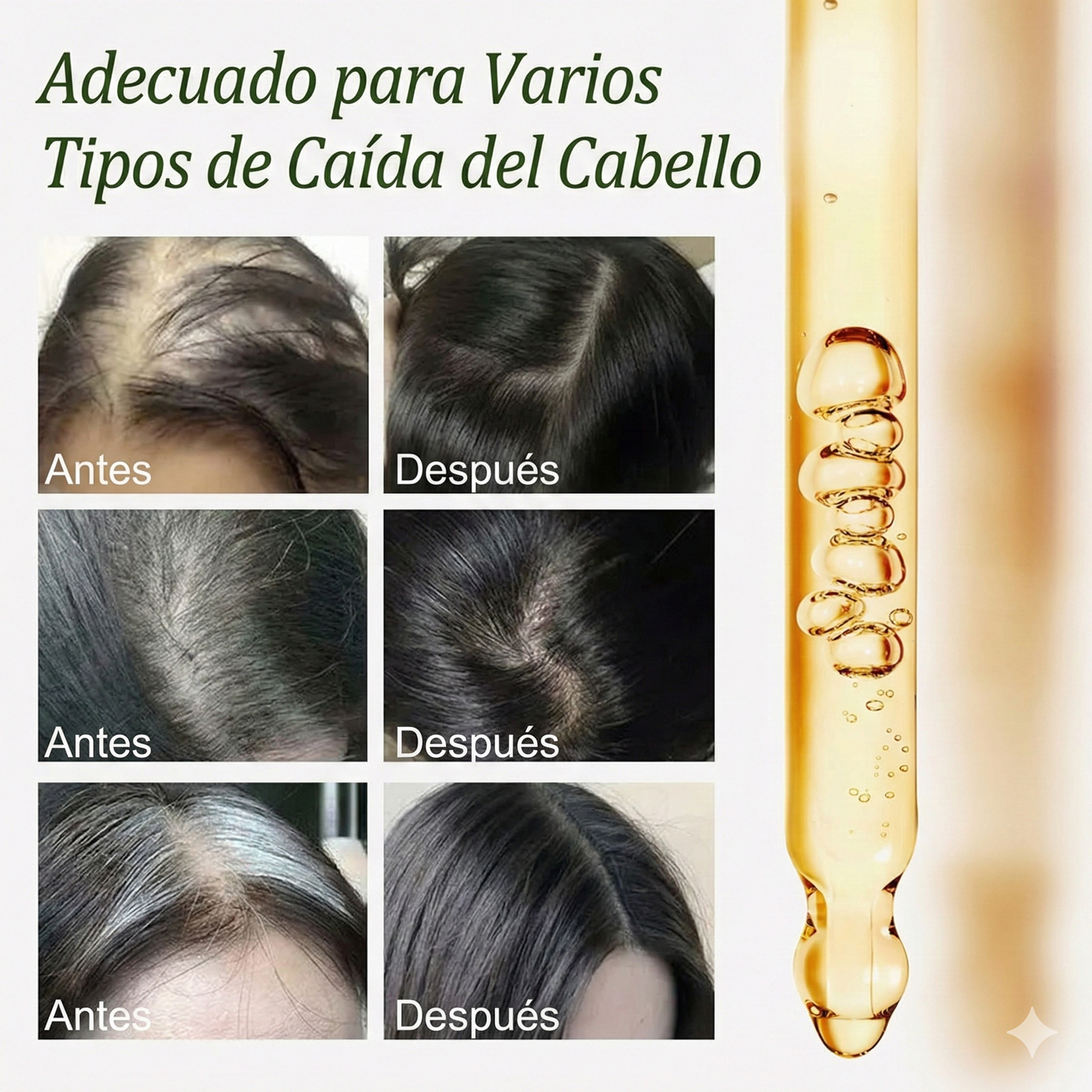 Batana Pro🔸 - Fortalece el cabello y mejora la densidad