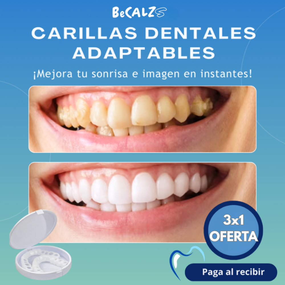 😁Sanp On Smile®: Carillas adaptables para una sonrisa perfecta.