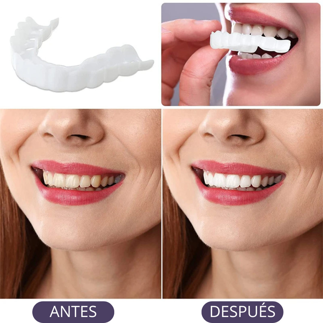😁Sanp On Smile®: Carillas adaptables para una sonrisa perfecta.