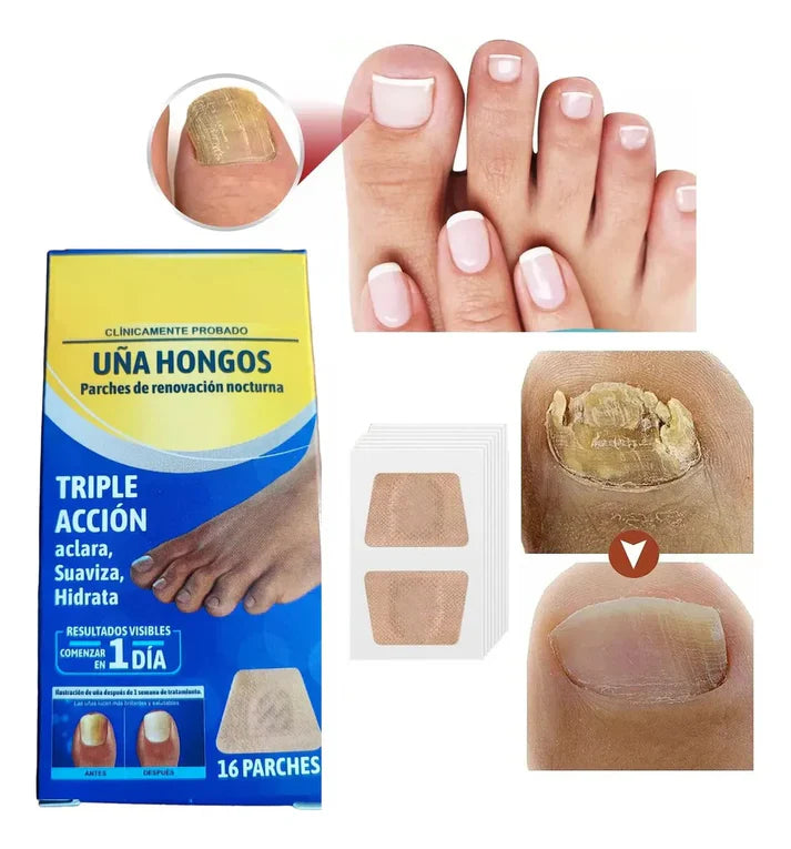 RenovaParch® -  Elimina hongos y recupera uñas saludables en pocas semanas